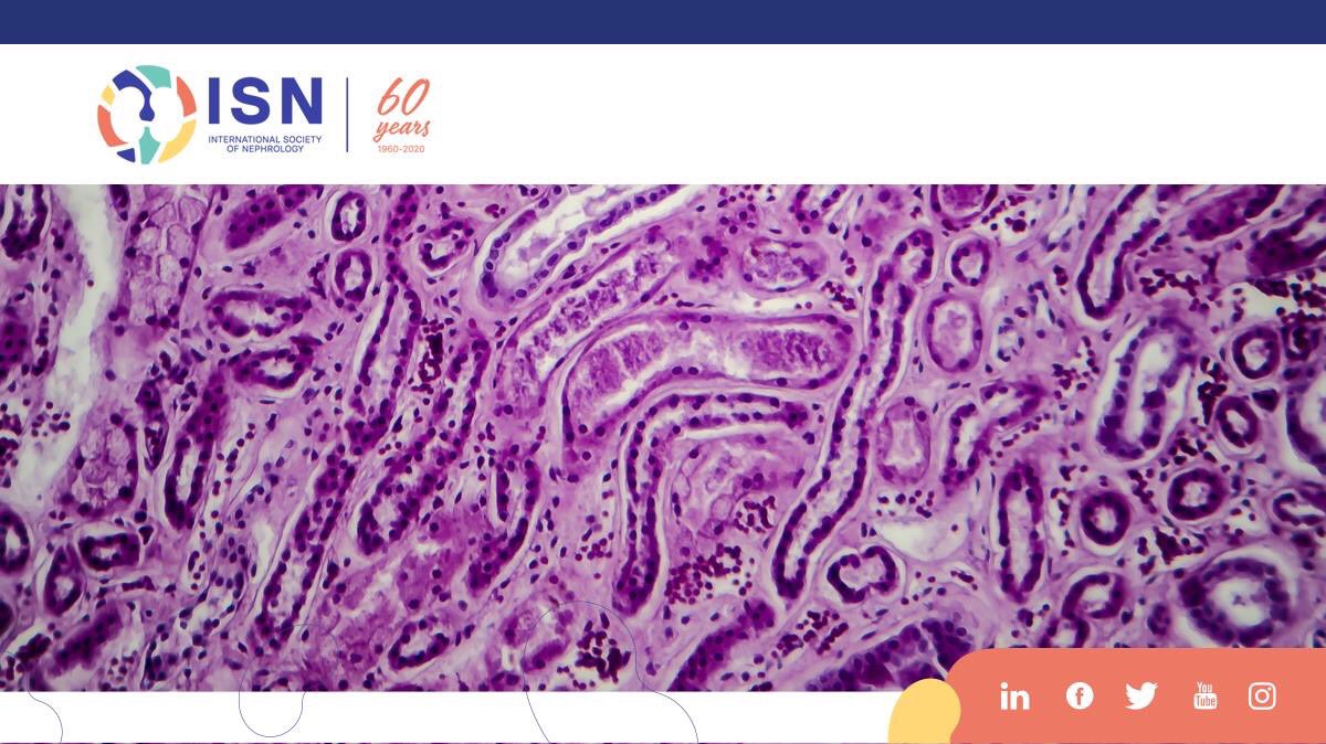 ISNkidneycare's tweet photo. The ISN-ANIO Clinical Nephropathology Certificate Program is a year-long online educational program in nephropathology open for applications.
Deadline to apply: Oct, 31, 2020.
More information: https://t.co/2OF0s0Mm2f or contact Dr. Farag at isnaniocnc@gmail.com #RenPath https://t.co/wtcMmuF7ze