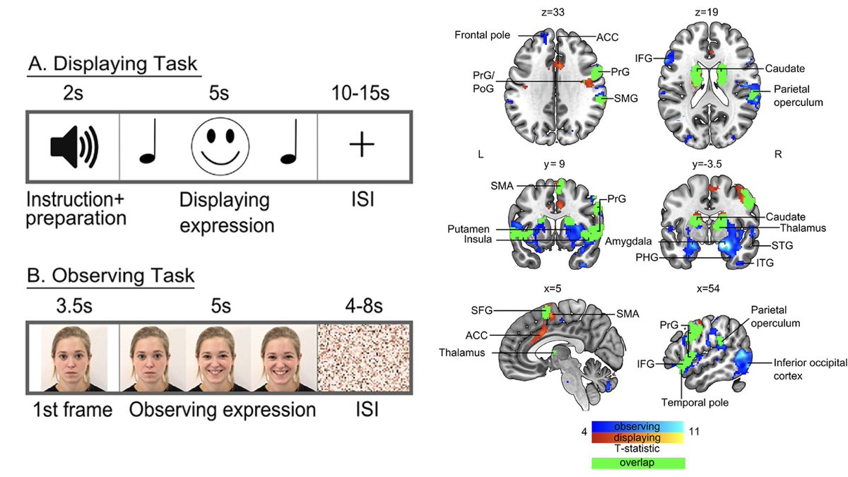 Facial "mirroring" supports emotion recognition -crossmodal  pattern classifier trained with brain activity during facial movements can accurately predict which facial expressions people see. #openaccess paper now out in @OUPMedicine SCAN: doi.org/10.1093/scan/n…