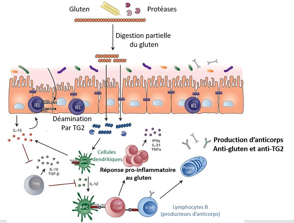 Cependant, c'est lié à une réaction anormale du système immunitaire. Les protéines du gluten sont résistantes à la dégradation gastro-intestinale. Le produit final de cette digestion partielle du gluten peut déclencher une rupture de la tolérance alimentaire