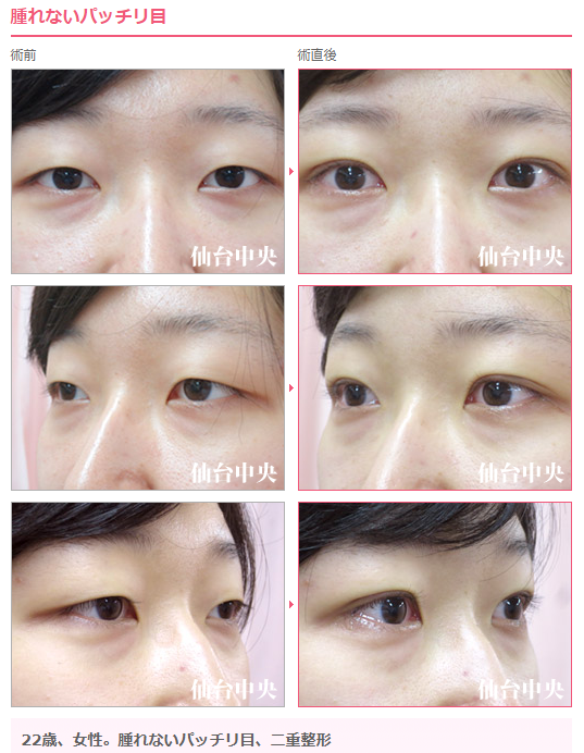 重い一重まぶた Twitter Search Twitter