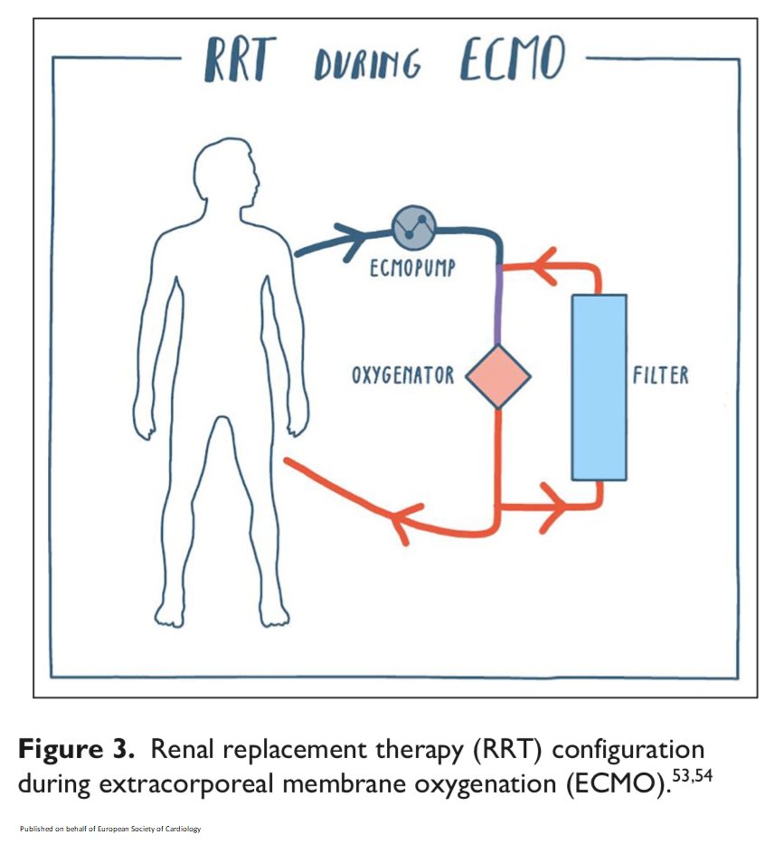 European Society of Cardiology Journals (@esc_journals) on Twitter photo When, how and in whom to start renal replacement therapy in acute #heartfailure: check this state-of-the art review.
bit.ly/349zZFr
#EHJACVC <a href="/ACVCPresident/">ACVCPresident</a> When, how and in whom to start renal replacement therapy in acute #heartfailure: check this state-of-the art review.
bit.ly/349zZFr
#EHJACVC <a href="/ACVCPresident/">ACVCPresident</a>
