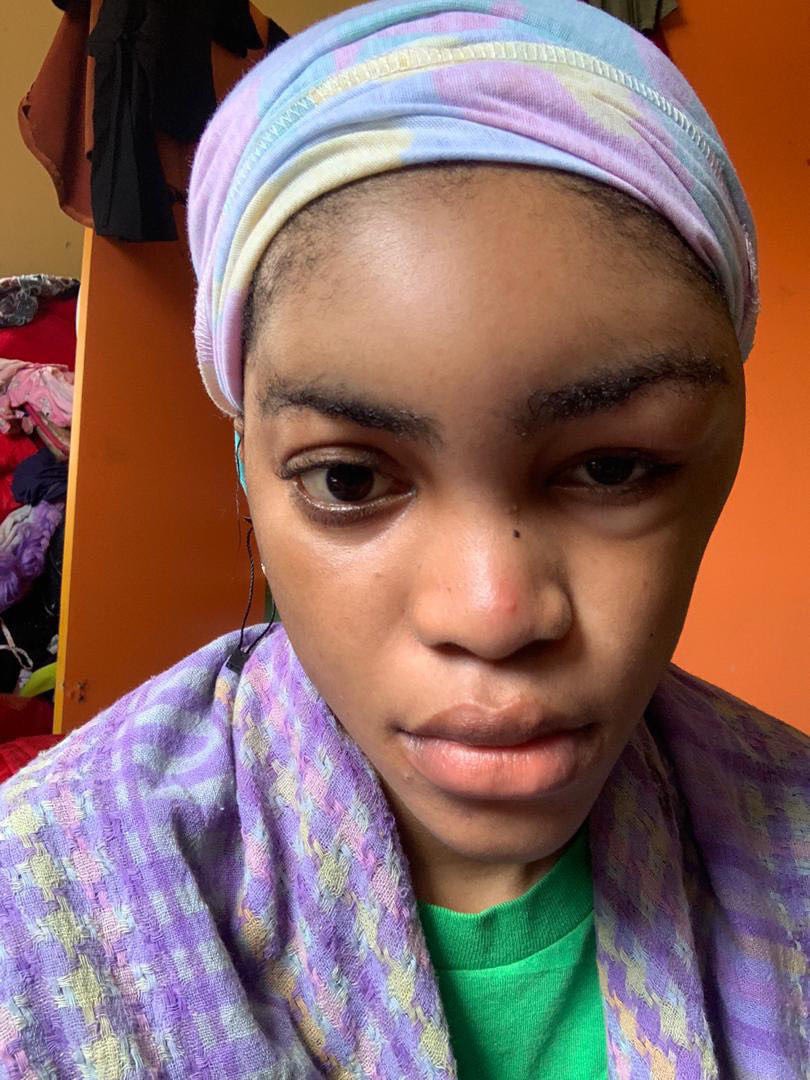 DOMESTIC VIOLENCE THREAD  @davido this is what your artist has been doing to my client. FROSH  @UnclePamilerin please help me fight for justice  #DomesticAbuse  #DomesticViolence  @LanumiLois  @Fahrenthold  @datcoolgaffy  @Goldentoms_