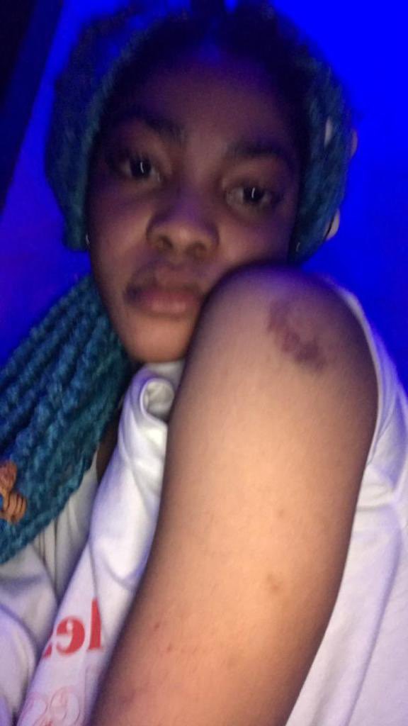 DOMESTIC VIOLENCE THREAD  @davido this is what your artist has been doing to my client. FROSH  @UnclePamilerin please help me fight for justice  #DomesticAbuse  #DomesticViolence  @LanumiLois  @Fahrenthold  @datcoolgaffy  @Goldentoms_