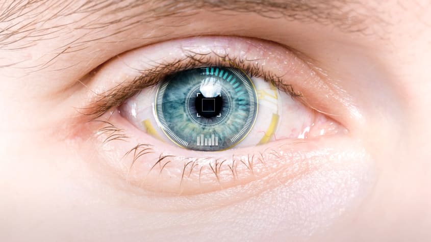 желто карие глаза. глаз офтальмология. красивые зрачки глаз. глаз и солнце. пока светит солнце глаукома.