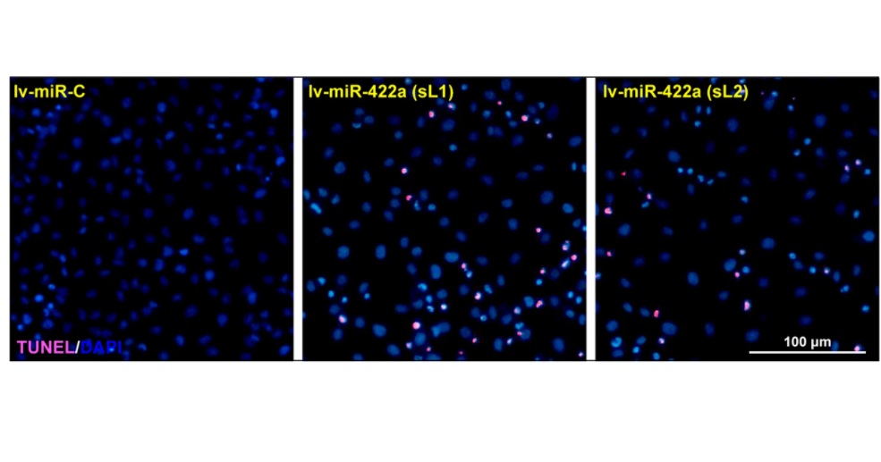 NeuralCell's tweet photo. π¨βπ¬Researchers found that Lnc-D63785 m6A methylation by OGD/R causes miR-422a accumulation and #NeuronalCell apoptosis.
@cddpress: https://t.co/5RCehrzHAS https://t.co/0WvT2XSTqC