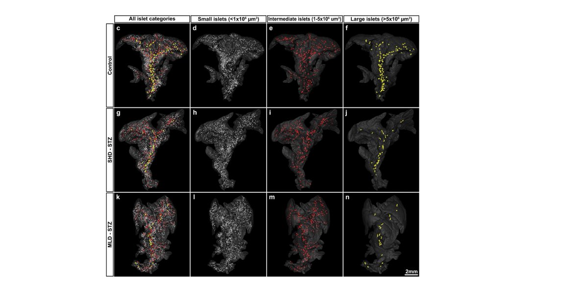 🔎 Researchers from @UmeaUniversity show that hyperglycemic #Streptozotocin-treated mice still harbor a large pool of remaining β-cells but display pancreas-wide downregulation of glucose transporter type 2. 

🔓 Open access go.nature.com/34zGkKT