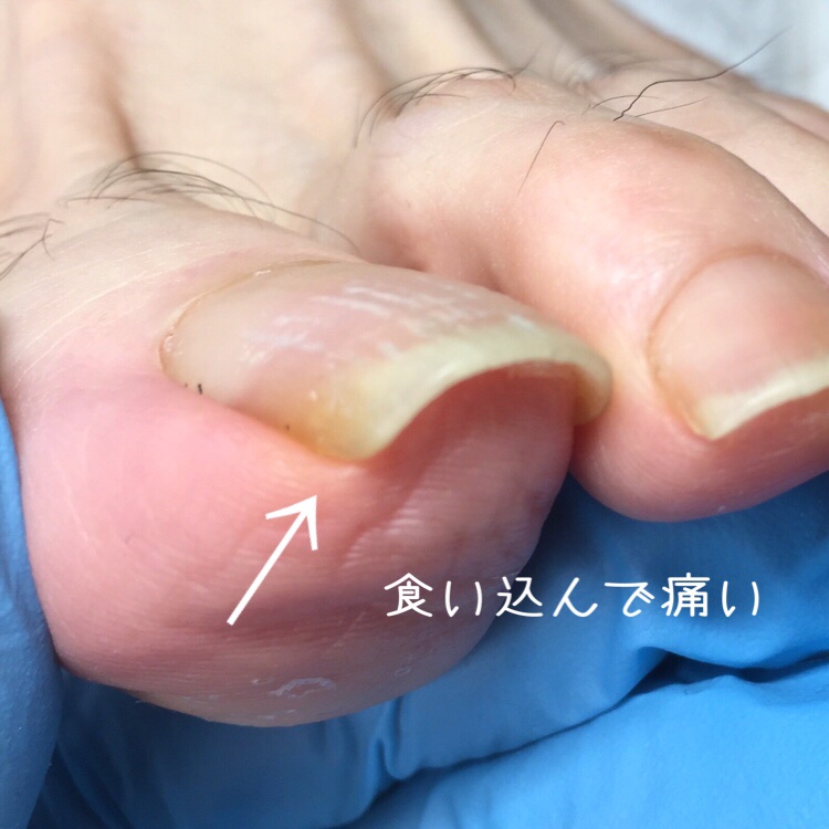 自宅ネイルサロン Ciao Ciao Twitter 自宅ネイルサロン Ciao Ciao Twitter