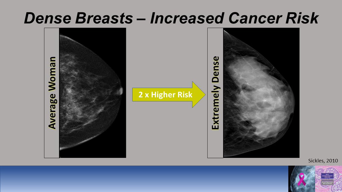 7/ DENSE breast tissue can increase a woman's risk for breast cancer by 2x. This is because cancers can be hidden and also because the glandular tissue is more prone to making breast cancer