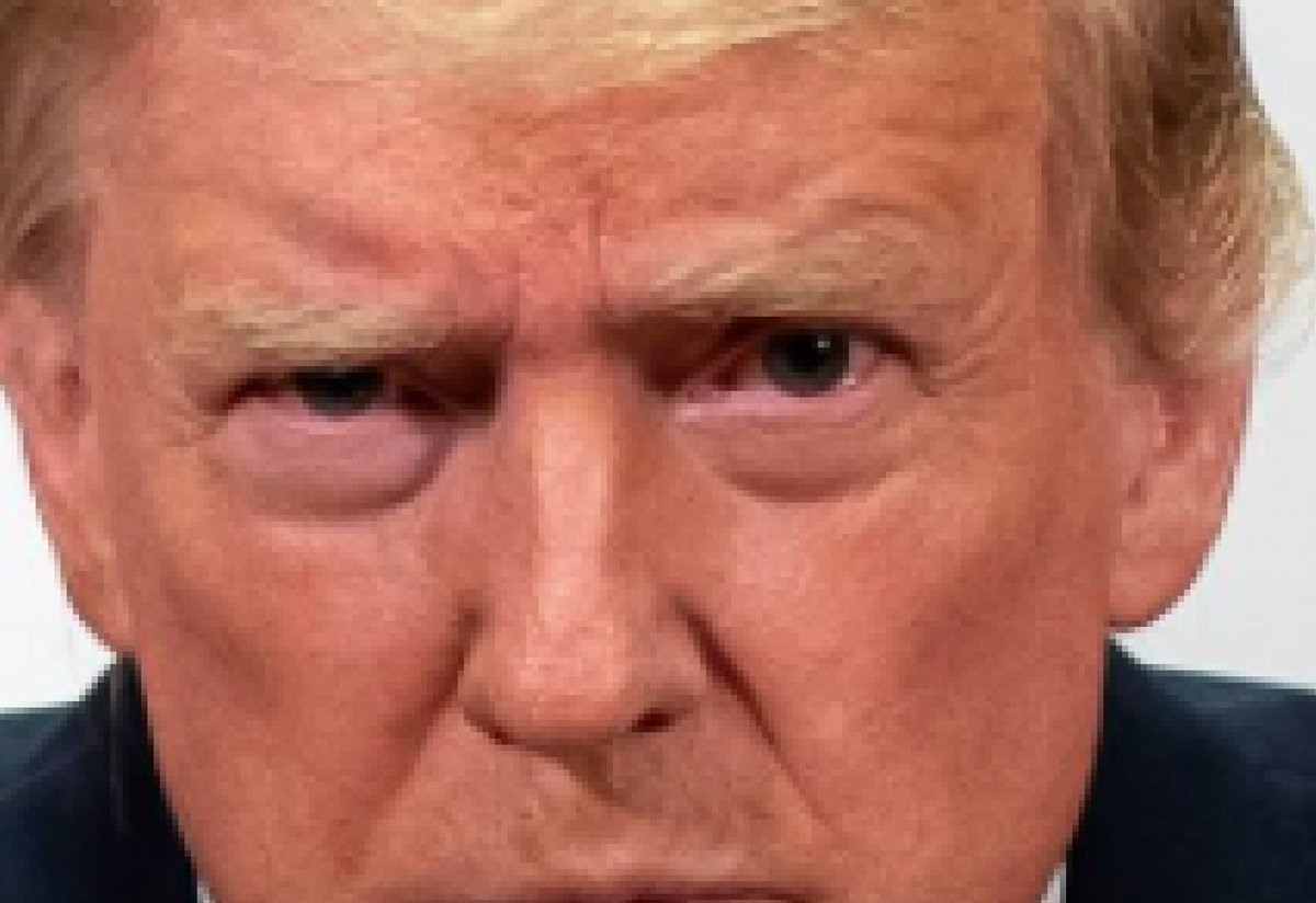 1/ THREAD: UPDATE:  #DonaldTrump •  #DilatedPupils Alert • 04 October 2020 • Walter Reed MC • Pupils dilated ~ 6.0-6.5 mm (right eye) ~ 6.0-6.5 mm (left eye) diameter, from image released by White House