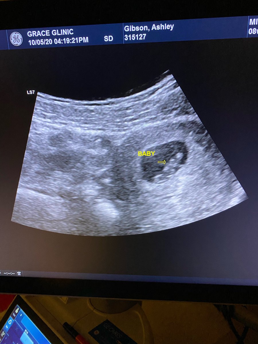 ace_high_ash's tweet photo. Well folks, it finally happened. Baby coming May 2021!🌵💗🦋 https://t.co/g81cmtmrQc