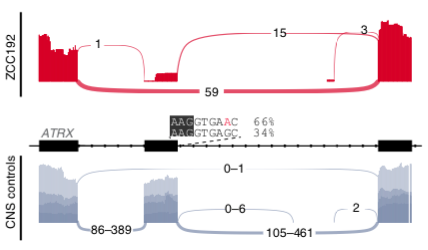 The combo of  #WGS+ #RNAseq provided insights into the functional impact of mutations on gene splicing. 9/28 splice-altering variants found by  #Introme were at atypical sites & RNAseq revealed exon skipping & whole or partial intron retention. led by  @PatSullivann /8