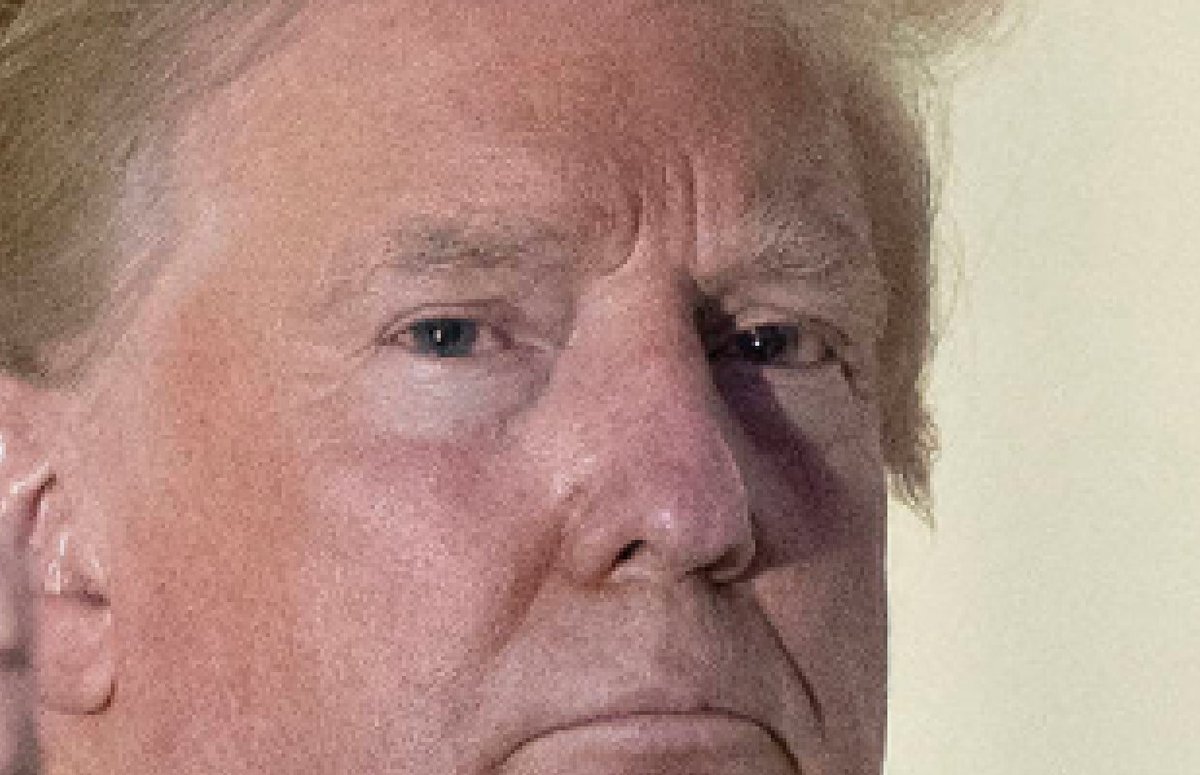 UPDATE: #DonaldTrump • #DilatedPupils Alert • 05 October 2020 • Walter Reed MC • Pupils dilated ~ 6.0-6.5 mm (right eye) ~ 6.5-7.0 mm (left eye) diameter, from images take a few seconds apart, White House balcony, just after Trump returned from Walter Reed Medical Center