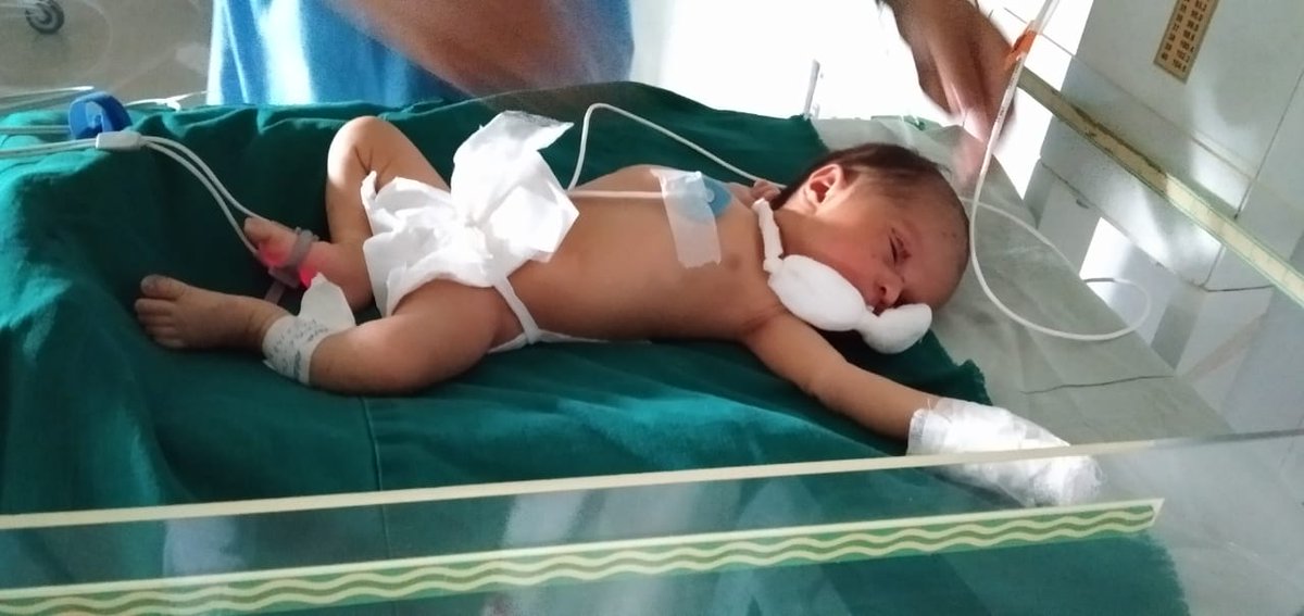 AssamCovid's tweet photo. MMCH Covid Hospital

'Miracle' baby found on the roadside was brought to the hospital in a critical condition &amp; got treated by a team of #Doctors. Superintendent Dr Anupal Kumar Sarma said the hospital is taking the responsibilities of the baby and also gave her a name 'Lakshmi'. https://t.co/S3LQF5y5uf