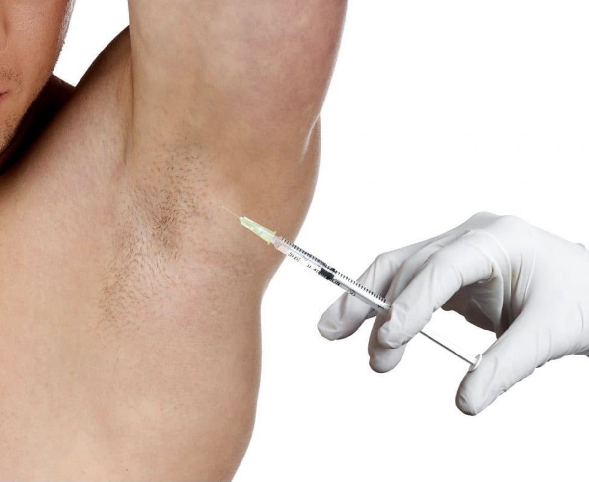SkinHD_UK's tweet photo. Botox can help curb the symptoms of hyperhidrosis ( excess sweating ) for up to 6 months from a single treatment for just £350 at SkinHD!⁣⁣
⁣⁣Call us now on 0161 974 0212 to book in for your free online consultation! ⁣⁣
⁣⁣#Hyperhidrosis #ExcessiveSweating #Botox #SkinHD https://t.co/K9PuPbbeH5