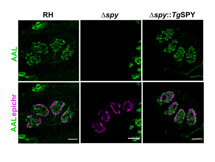 SPY-ing on O-fucosylation in Toxoplasma gondii prelights.biologists.com/highlights/the…

By @jablack18 on preprint from @bandigiu & co. with thoughtful author's response
