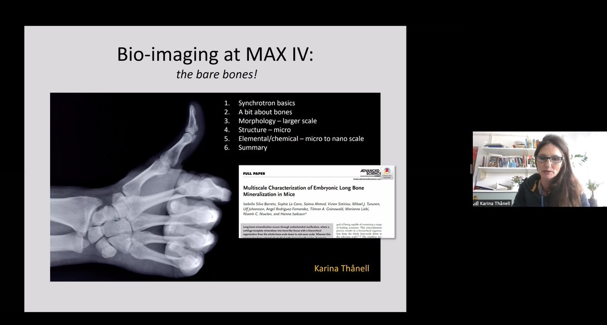 HALRIC_EU's tweet photo. @harbor_unihh @MAXIVLaboratory @ThornLab Thumbs up for the talk by Karina Thånell today at the launch of the HALOS webinar series on Life Science and Innovation around and at the large scale facilities MAX IV, ESS, E-XFEL and DESY. #life_science @MAXIVLaboratory @medfak_LU #overgransen https://t.co/Z1zNNDUxVH