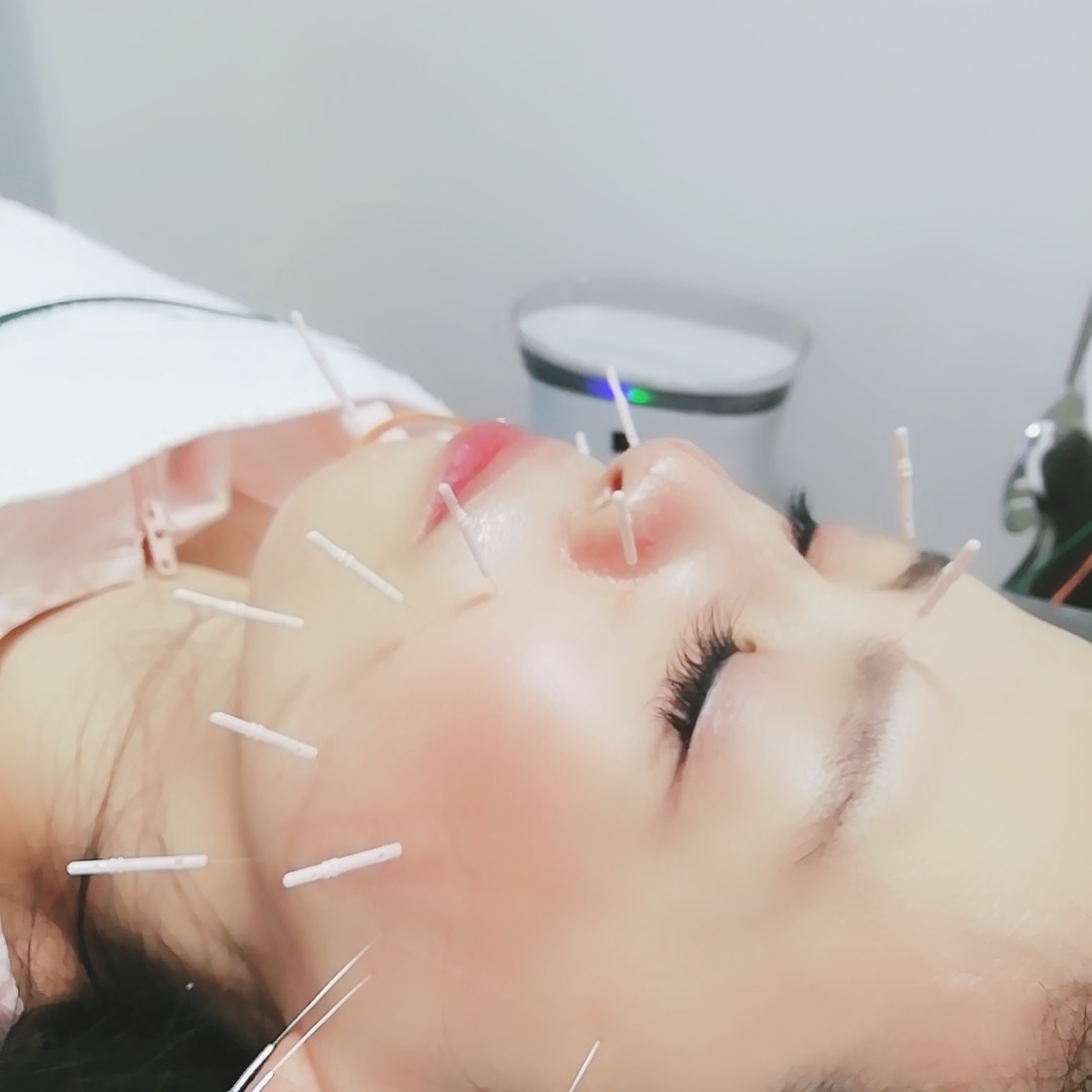 電気美容鍼東京 不妊 自律神経鍼灸 女性限定sola Akasakanosola Twitter