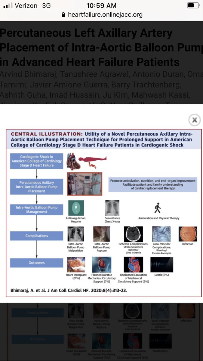 Axillary Iabp useful but comes with nuances-pointed out by @UlrichJordeMD @hfsa. Paper in JACC-HF published this year details- The largest experience with Perc-axillary Iabp. @JerryEstepMD @davebaran @VorovichHeartMD @bhtrachtenberg @mahwash_kassi @NavinKapur4 @NirUrielMD