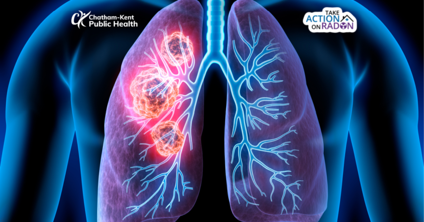 yourtvck's tweet photo. Join @CKPublicHealth for an online Radon Information Session on November 3rd, 6:30-7:30pm.
Get a #free kit to test your home for Radon.
175 Kits Available
Click here to register or call 519.355.1071 ext 2902
https://t.co/Rz6BpadTVW
#YourTVCK #Ckont #CK #CKPublicHealth #CKPH https://t.co/H9aoCoQ0M6