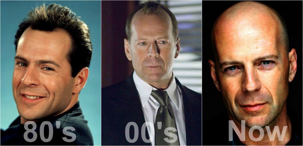 Bruce Willis is yet another good example...I think you get the idea. If you're losing it, embrace it.