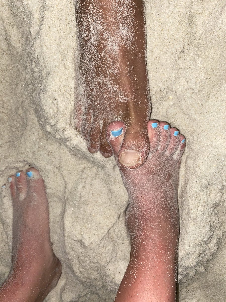 factory_foot's tweet photo. Anyone want a toe hug?🤪 #feet #FOOTFETİSH #footfreaks #feetpics #feetpicsforsale #onlyfans #onlyfansfeet #mensfeet #womensfeet #couplesfeet #beach #vacation #nasty #FeetBit #FootTease #FootJobFriday #footsmelling #footjobandmodels https://t.co/mFfJUvJYX6