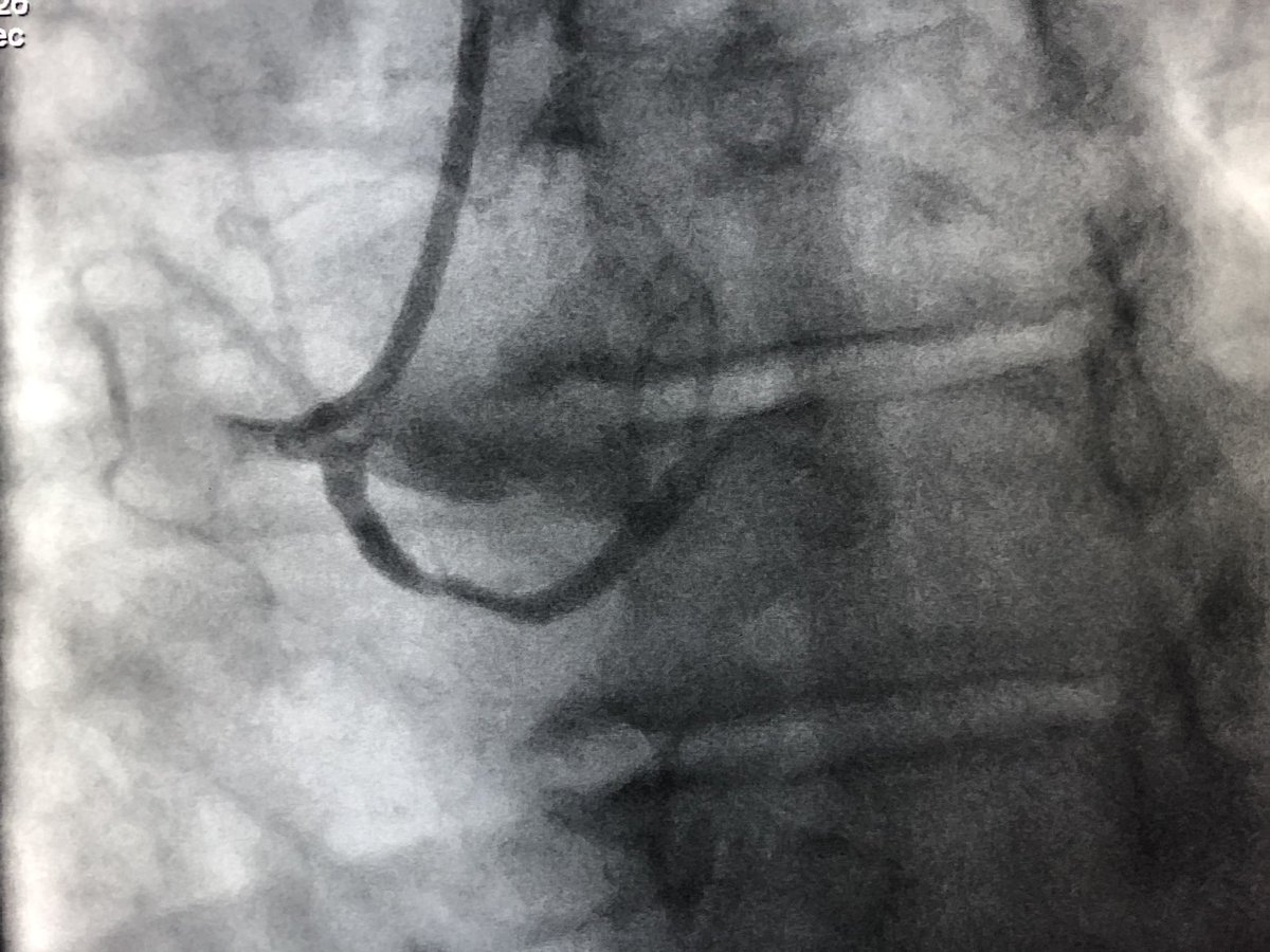 Pooja Swamy, MD, FACC, FSCAI tweet media