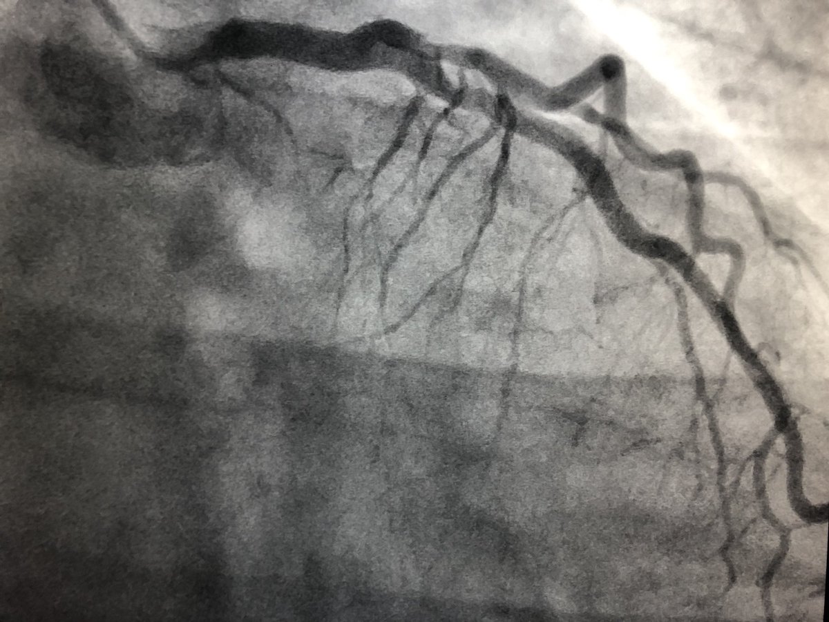 Pooja Swamy, MD, FACC, FSCAI tweet media