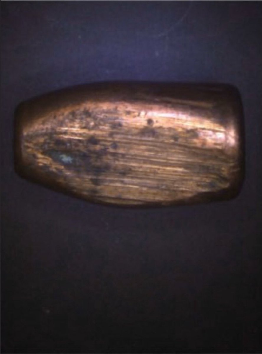 El Microscopio Electrónico de la Com. Nac. de Energía Atómica probó que la bala que disparó Chocobar rebotó contra el pavimento de la calle y tiene aplastamiento lateral. Los hechos son sagrados, las interpretaciones son libres. No disparó a la espalda. Disparó al suelo.