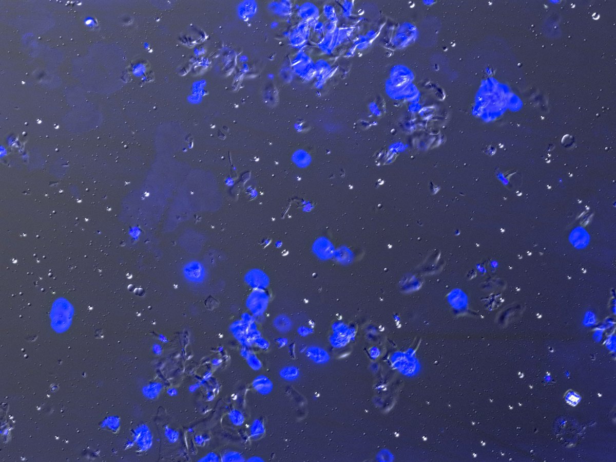 ArGo0017's tweet photo. Pure nuclei, ready for FACS #ISLAB #CCMB https://t.co/GW0lpRmv74