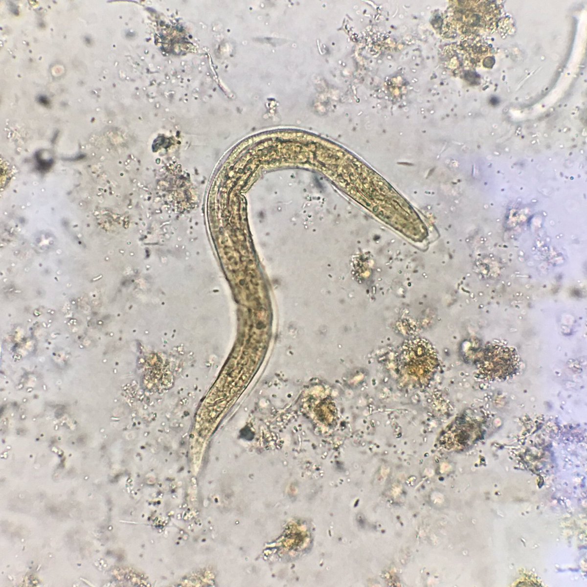 MFeelyDO's tweet image. Finally watching the last season of #SchittsCreek so I figured I’d share these appropriately themed snapshots. 

Look mom, no eggs! #parasite #pathology