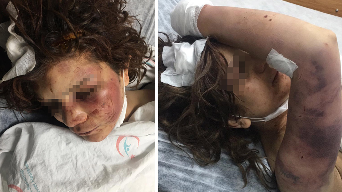 Bunun adı 'kadına şiddet' değil, başka bir şey! 5 gün boyunca odaya kilitlediği eşini zincirle dövüp, tırnaklarını kerpetenle çekti

karar.com/5-gun-boyunca-…