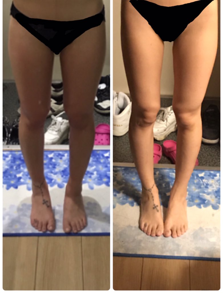 A ついに昨日筋トレ始めてから 約半年経過して 始めて40kg代きれた もとは43 44kgなので そんなに大幅に体重減った訳では ないけど筋肉ついたら 体が本当に変わった 写真見てえ 足長くなった って思っちゃった まだ満足してないので 継続して