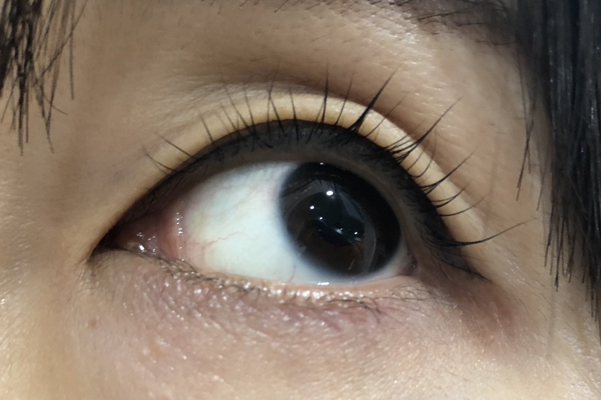 プランプラッシュリフト