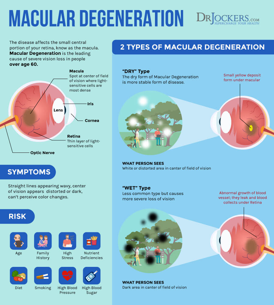 How much do you know about this age related eye condition? Macular degeneration is prevalent and may result in ‘legal blindness’. To learn more, click the link below. #maculardegeneration

drjockers.com/macular-degene…