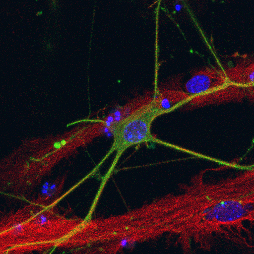 KCLstemcells's tweet photo. Another wonderful #RecreateScience entry! The image of a #neuron by @neuro_gaby was recreated with painted dried wet wipes!
Have a go here: https://t.co/pE6jR5cC2z
#sciart #kingsculturalcommunity #StemCells @kingsmedicine @GSTTresearch @CulturalKings @eurostemcell https://t.co/FLI8atBCmp