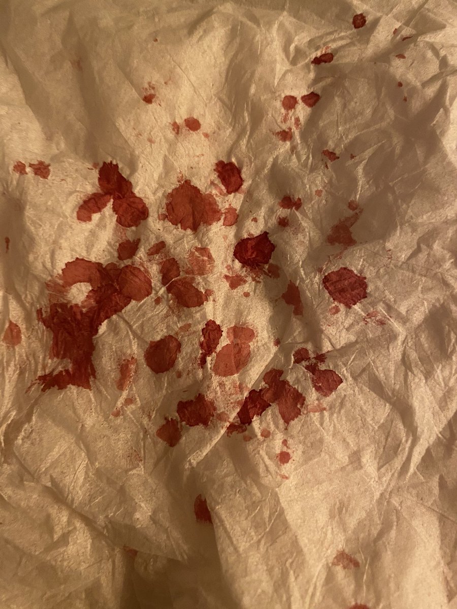 みなみちゃん 足切ったら親にすぐ見つかって怒られたのであざに変更します