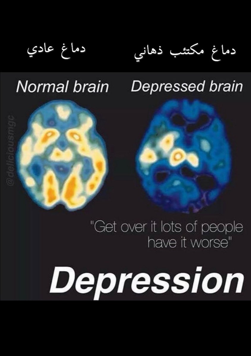 مساء الخير في هذا الثريد حعرض لكم مسح دماغي شفتو عند مركز مساحة توازن المميزين   و هذا المسح حيكون بين الدماغ السليم و  دماغ الاشخاص المضطربين نفسياً خلونا نشوف مع بعض ..
<a href="/TawazonSpace/">Tawazon Space | مركز توازن للإرشاد الأسري</a>