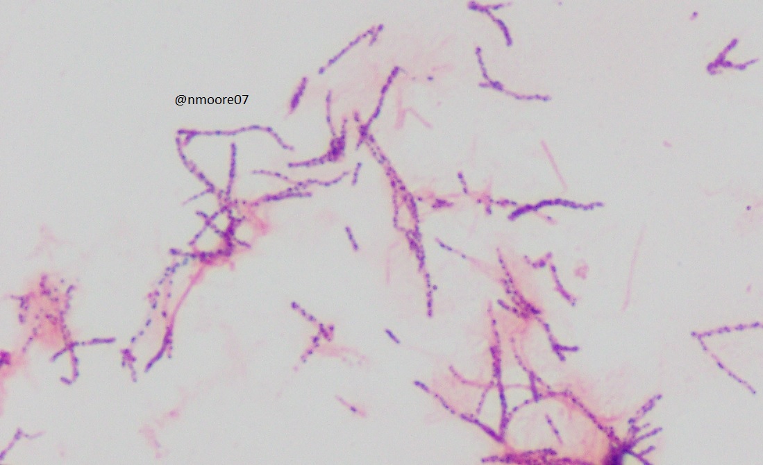 #MicroRounds day 82: Hello Mr/Ms. beaded Gram-positive rod. Organism ...