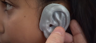 scarfreeworld's tweet photo. 'The major focus of our research is 3D printing tissue-engineered cartilage for use in facial reconstruction; initially in the paediatric population' 

The team are creating a pioneering treatment allowing printed living tissue to be tailored to the individual needs of patients. https://t.co/MQ60bO8xz0