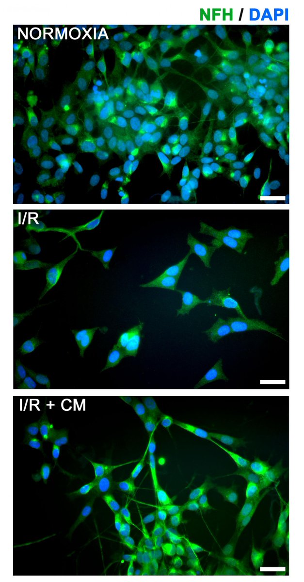 StemCellsTM's tweet photo. Early pre-clinical results show that amniotic fluid may yield new, better treatment for ischemic stroke.
#ischemiareperfusion #stroke #miRNA #exosome #stemcells #amnioticfluid, #conditionedmedium #cerebralischemia #oxygenglucosedeprivation
https://t.co/W6AQQLkcKi https://t.co/ZCWOKnNuET