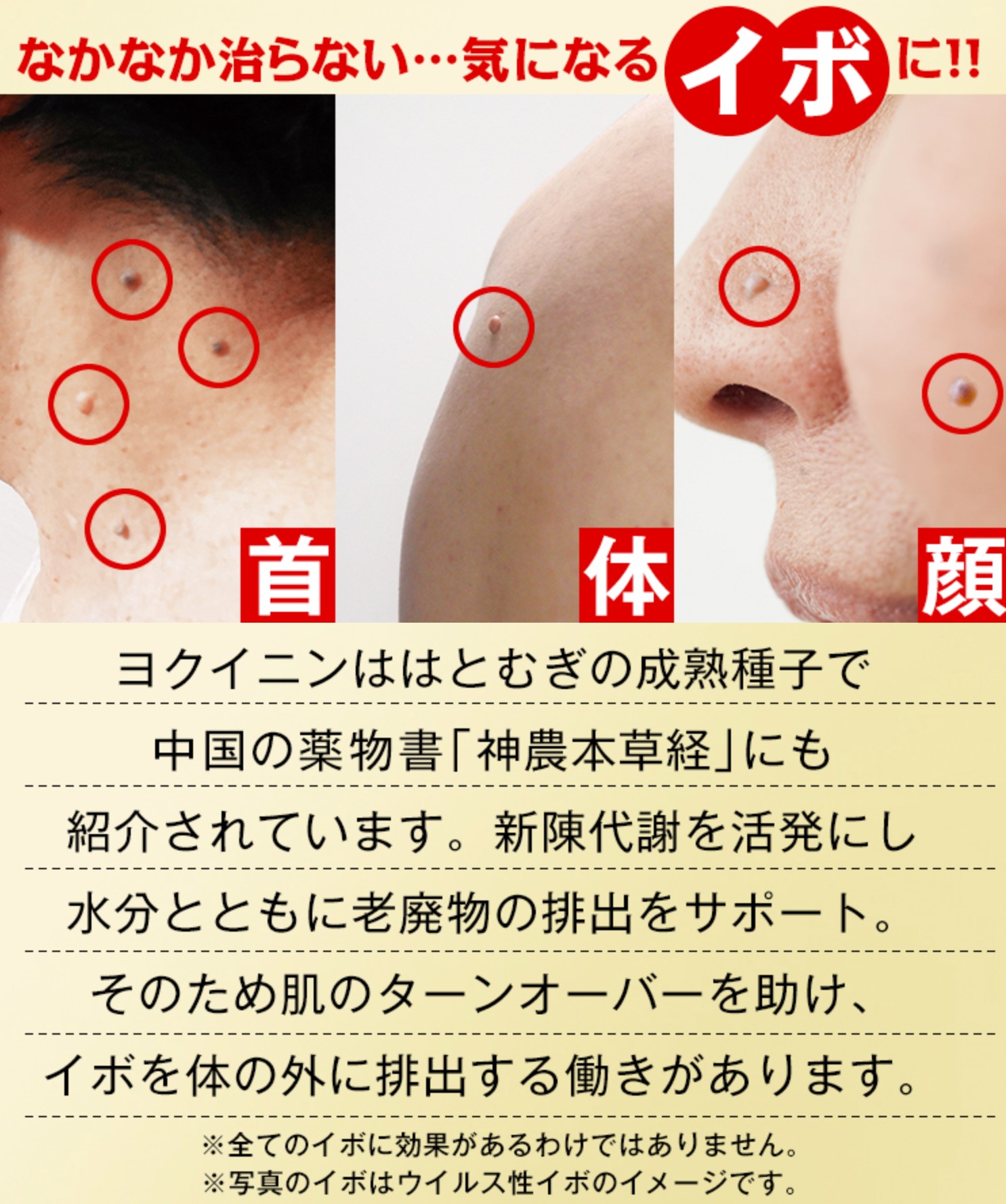 やさひふ 皮膚科専門医 医学博士 Lumedia編集長 ヨクイニンで首イボ解消 ヨクイニンのサプリや塗り薬が首イボ解消目的に宣伝される 実際は ヨクイニンが使われるのはウイルス性のイボだけで 首等に多い加齢性のイボには効果なし 日本皮膚