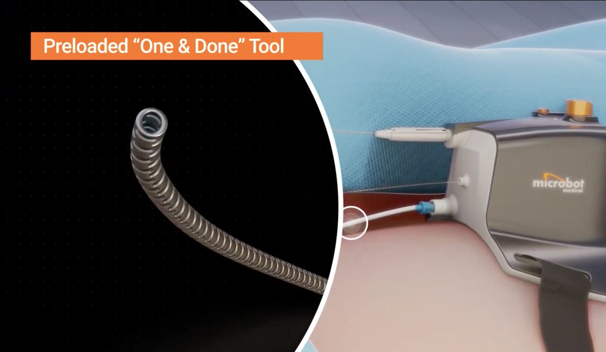 MicrobotMedical's tweet image. Witness the revolution! Here's a demo of our LIBERTY™ disposable #roboticsystem: buff.ly/2B364E7 #medicaltechnology