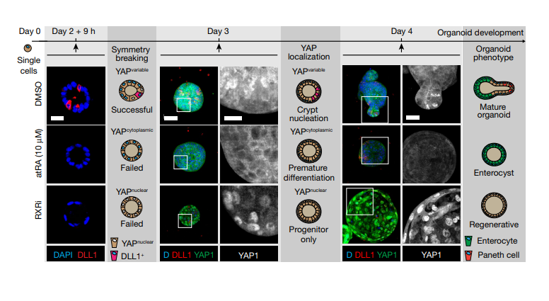 Intestinal_Cell's tweet photo. Congratulations 🎉 to @priscaliberali and @UniBasel colleagues on their research published in @nature!
Phenotypic landscape of #IntestinalOrganoid regeneration.
https://t.co/7IVpkBGQqv https://t.co/RocWmV1Dy7
