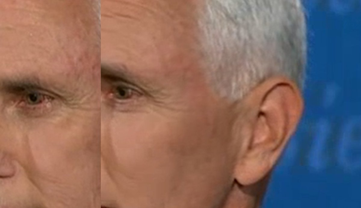Is Pence's eye OK?