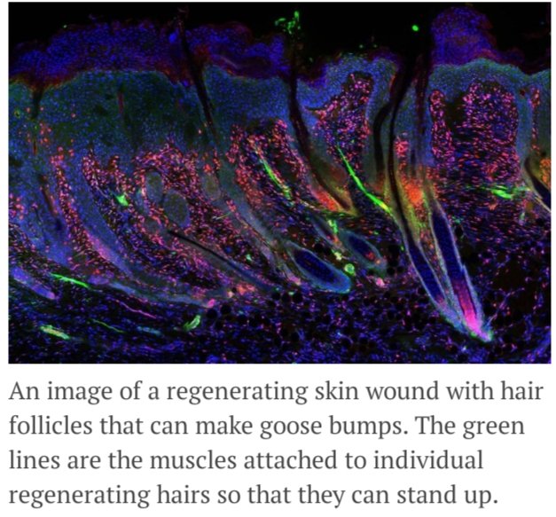 machine_ml's tweet photo. RT @xaelbot: RT @Analytics_699: New #genetic factor discovery allows #Oldskin imaging like #neonatal ▶️
#Analytics #MachineLearning #AI #Java #RStats #reactjs #IoT #IIoT #BigDatA #5G #CloudComputing
#DataScience #WomenWhoCode
#healthcare #HealthTech #Io… https://t.co/mCqNj7bYrq