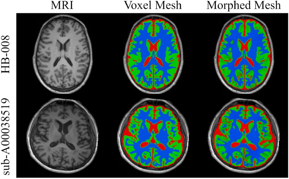 ABME (@abmejournal) on Twitter photo <a href="/MBPanzerLab/">Panzer Lab at UVA Center for Applied Biomechanics</a> paper "An Image Registration-Based Morphing Technique for Generating Subject-Specific Brain Finite Element Models" can be found in the October Issue of the <a href="/ABMEjournal/">ABME</a> <a href="/DruzgalLab/">Druzgal Lab</a> <a href="/uva_rc/">UVA Research Computing</a> <a href="/UVARadiology/">UVA Radiology</a> <a href="/BMESociety/">Biomedical Engineering Society</a> <a href="/SpringerNature/">Springer Nature</a>
Link: rdcu.be/b8eFV <a href="/MBPanzerLab/">Panzer Lab at UVA Center for Applied Biomechanics</a> paper "An Image Registration-Based Morphing Technique for Generating Subject-Specific Brain Finite Element Models" can be found in the October Issue of the <a href="/ABMEjournal/">ABME</a> <a href="/DruzgalLab/">Druzgal Lab</a> <a href="/uva_rc/">UVA Research Computing</a> <a href="/UVARadiology/">UVA Radiology</a> <a href="/BMESociety/">Biomedical Engineering Society</a> <a href="/SpringerNature/">Springer Nature</a>
Link: rdcu.be/b8eFV