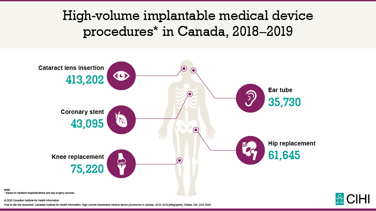 CIHI_ICIS's tweet image. Today is World Sight Day. According to our latest data, #CataractSurgery was one of the most common implantable medical device procedures done in Canadian hospitals. ow.ly/PIW750BaW44 #MakeVisionCount