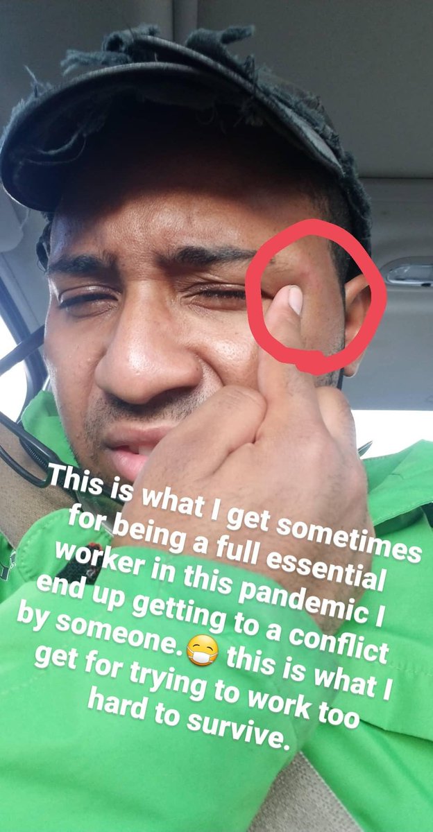 jollykaster's tweet photo. This is what I get for being a fully essential worker. I've ended up in someone else  Someone else's conflict and paying the price pain of for it! Got punched in the face.#EssentialWorker #beatup #hurt https://t.co/MArO7tQpQr