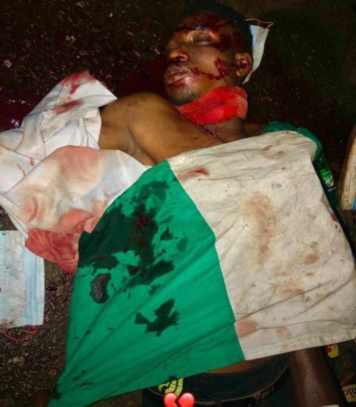 AnthonyIkegbune's tweet photo. Heartless politicians,they remove CCTV cameras,killed the youths and afterwards,order an investigation.

#EndSARS 
#Lekkitollgate https://t.co/EZzBXnvwqv https://t.co/IiInauAG53