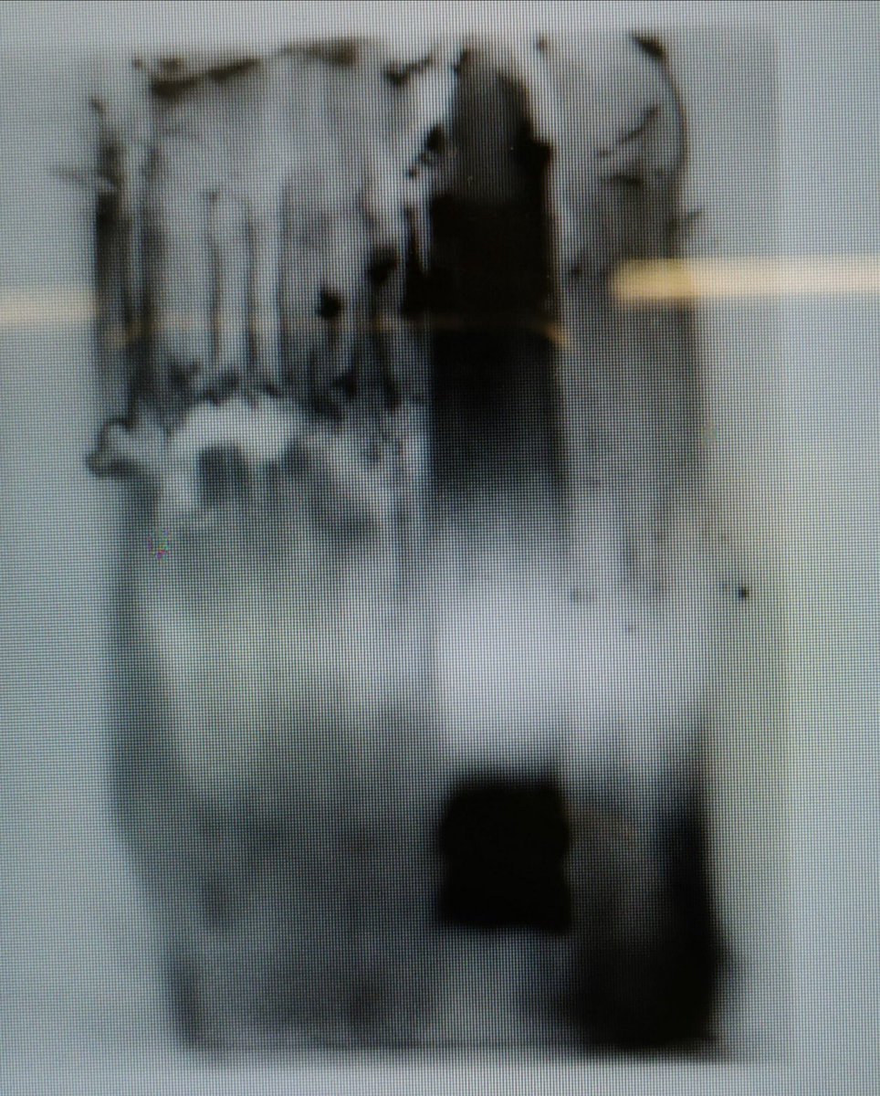 MargotRaffeiner's tweet image. This is what 2020 feels like.

#likeashittywesternblot #nexttry #staystrong #labdiaries